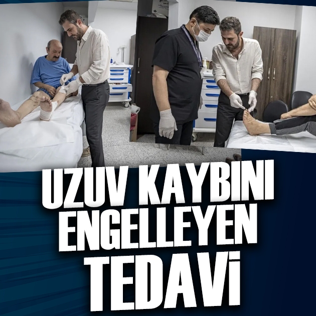 Kronik yaralara uygulanan tedavi uzuv kaybını engelliyor