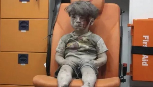 Ümran bebeğin son hali dikkat çekti