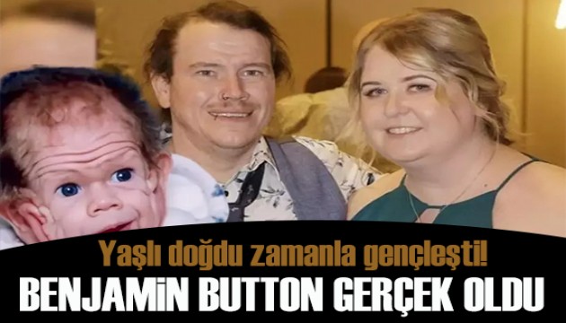 Benjamin Button gerçek oldu: Yaşlı doğdu zamanla gençleşti
