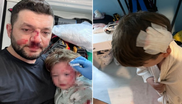 Yalova'daki komşu dehşetinde yeni gelişme: Bu kez oğlu saldırıya uğradı